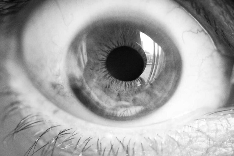 India Eye problems