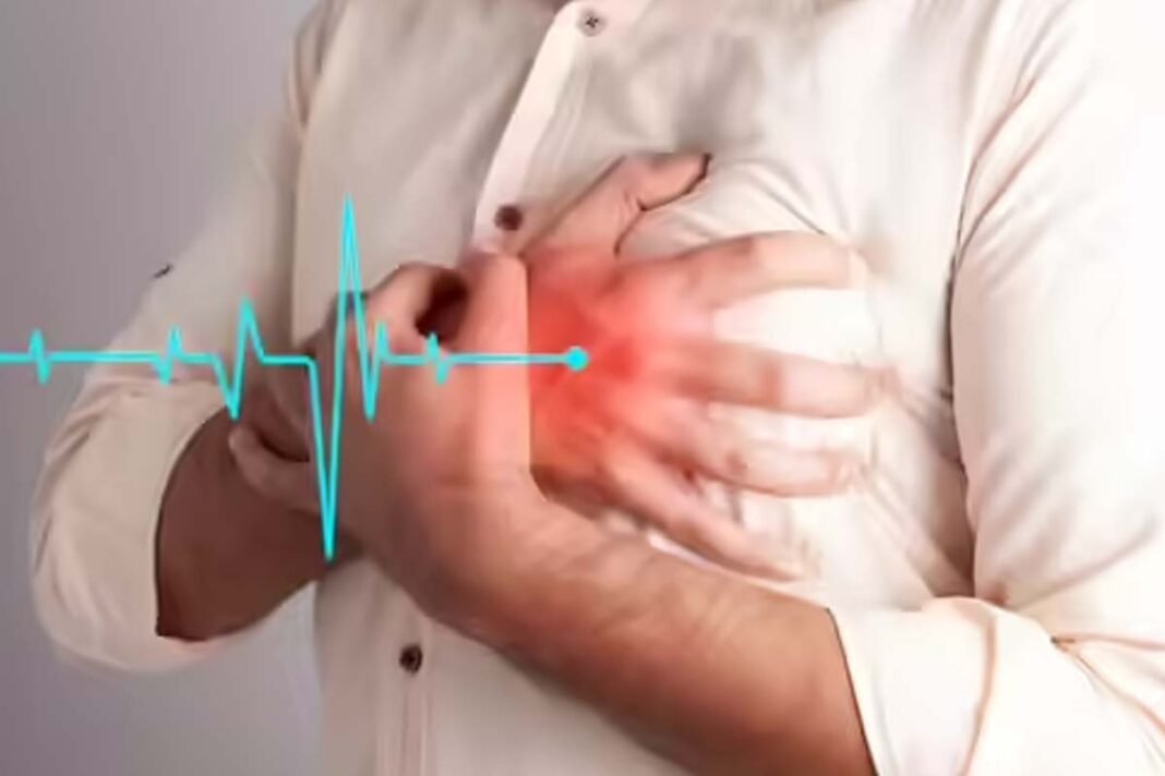 Heart Attack