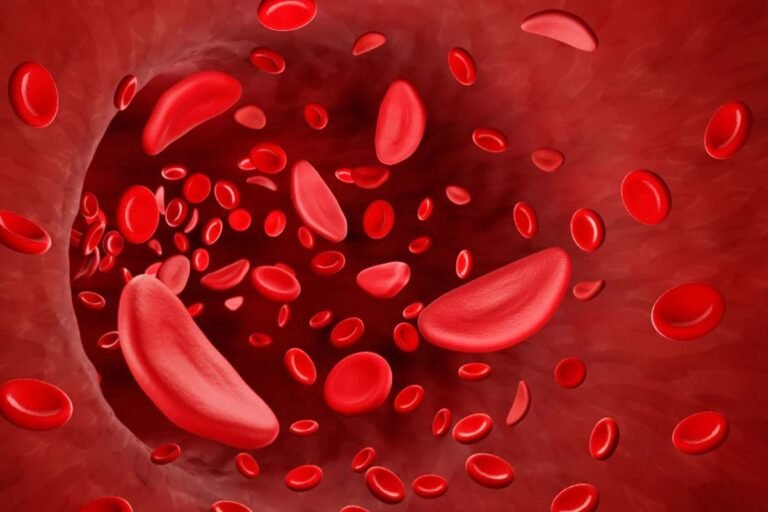 Sickle Cell Disease