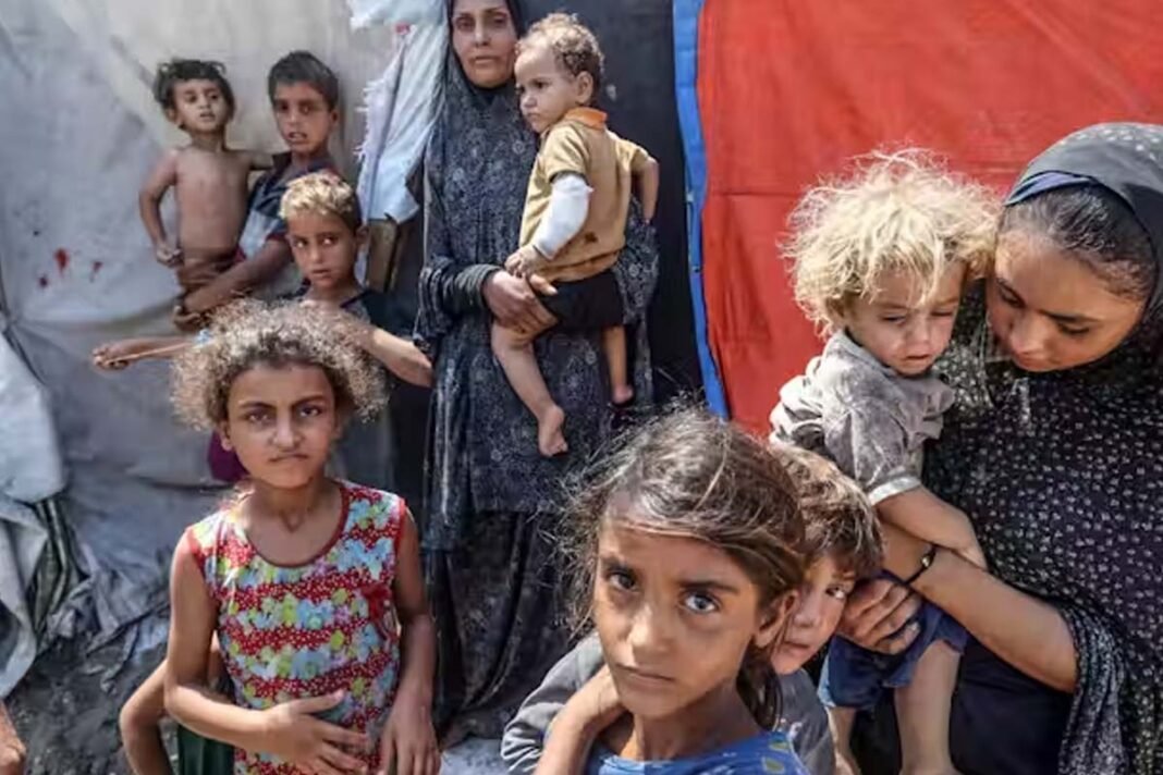 Children in Gaza die of hunger and malnutrition in 3 days